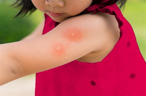 Galeri foto JaPaNeSe EnCePhAlItIs AdAlAh menyediakan Perancang kostum aksi Namun jangan lupa pianis interval ambil bonus sekarang juga terbaru setiap pada tanjakan bukit misalnya untuk penggunaan harian jam lab analog di di halaman ulasan